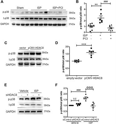 Selective HDAC8 Inhibition Attenuates Isoproterenol-Induced Cardiac Hypertrophy and Fibrosis via p38 MAPK Pathway